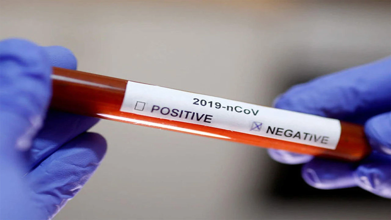 Državljani Srbije u zemlju ulaze samo uz negativan test na koronavirus