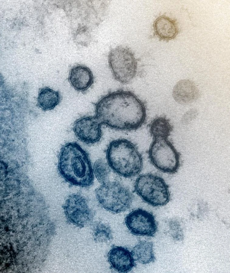Većina je uvjerena: Znamo li stvarno kako izgleda koronavirus?