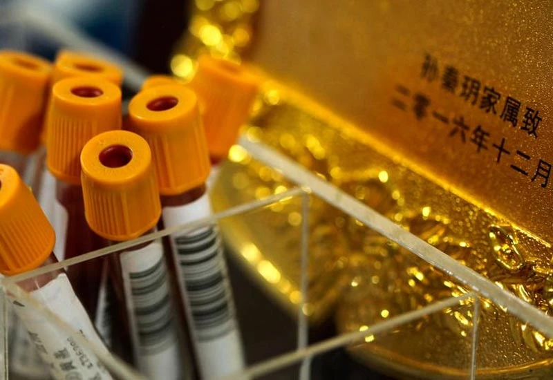 Kina: Još četiri slučaja nepoznate upale pluća