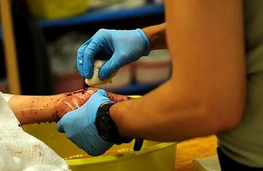 Žena ranjena na Baščaršiji, potraga za napadačem