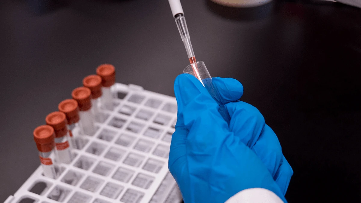 Otkrivena nova vrsta HIV-a