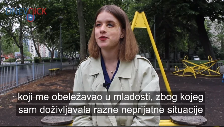 Život s ožiljkom na licu: Odrastanje uz uvrede