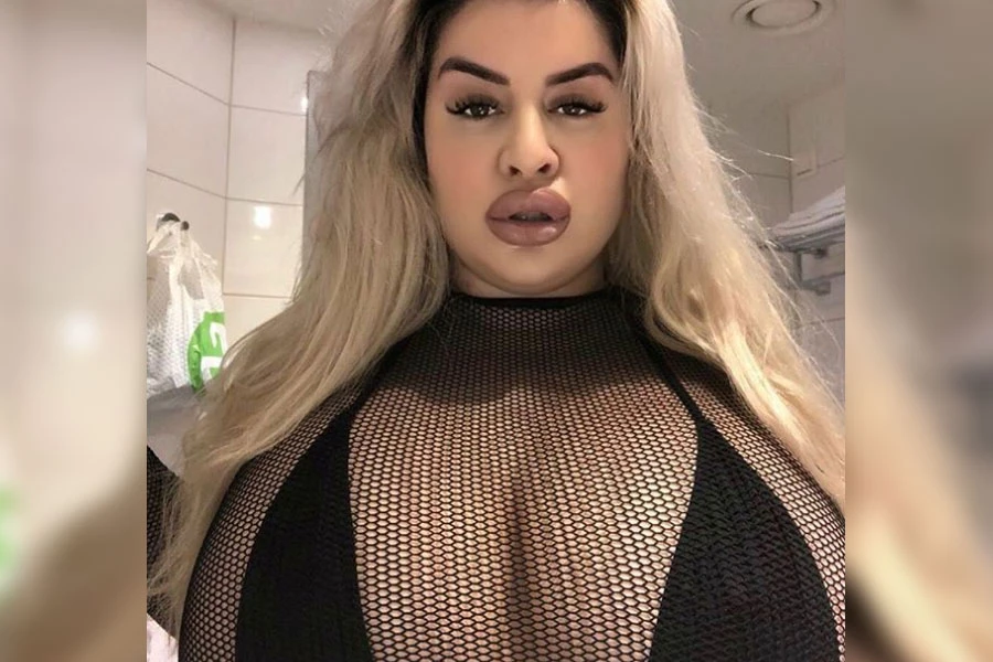 ‘Plus size’ model, zahvaljujući operacijama, želi biti kao Kim Kardashian