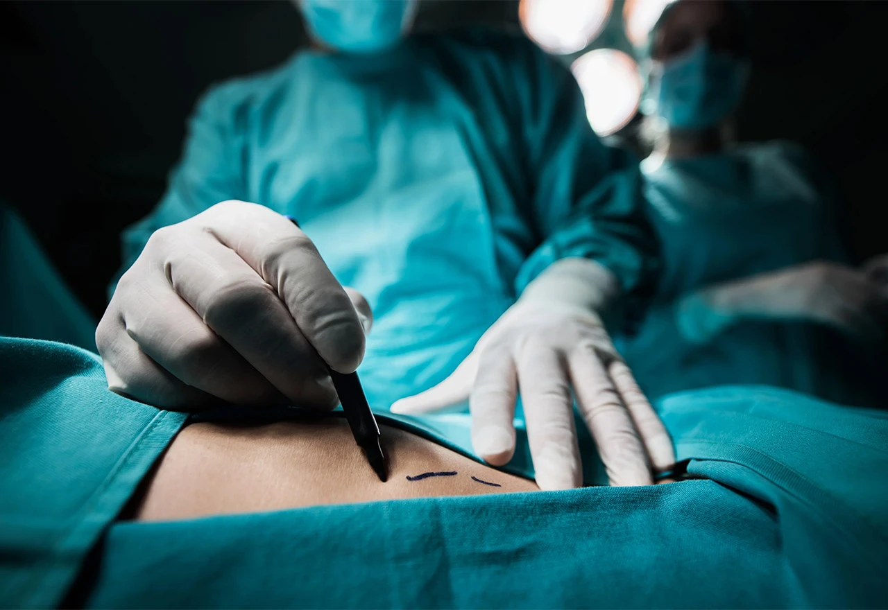 Urađena prva transplantacija bubrega jednog HIV pozitivnog pacijenta drugom