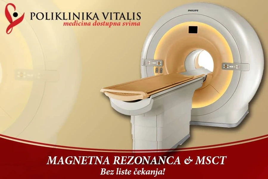 Velika akcija na radiološku dijagnostiku u Poliklinici Vitalis