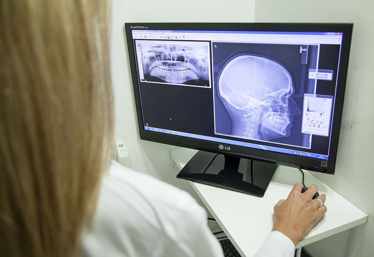 HNŽ: Digitalizira se radiološka oprema