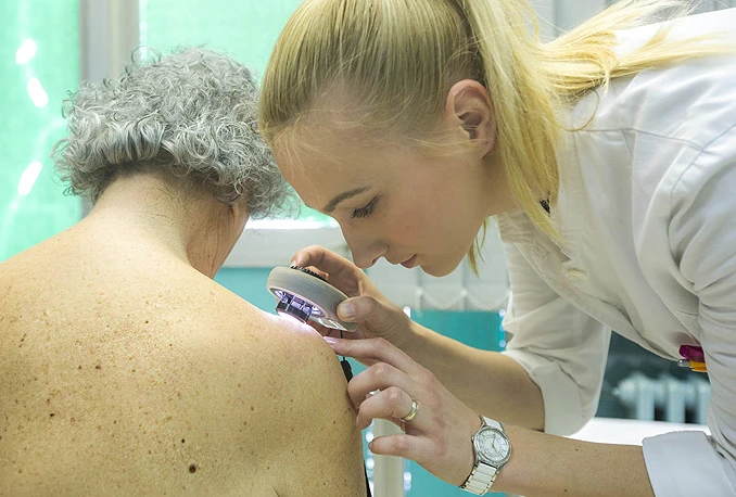 Mostar: Radionice o ranom otkrivanju melanoma kože, sluznice i oka