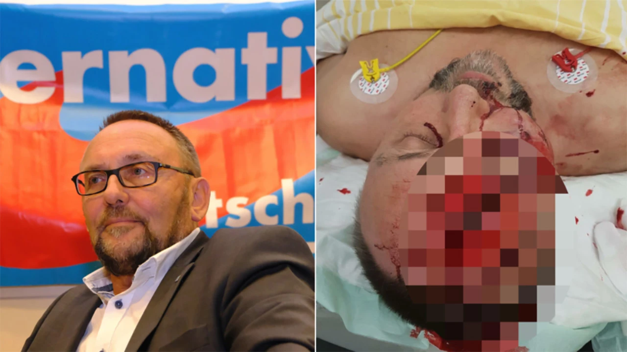  Lokalni lider AfD-a teško ozlijeđen u napadu u Bremenu