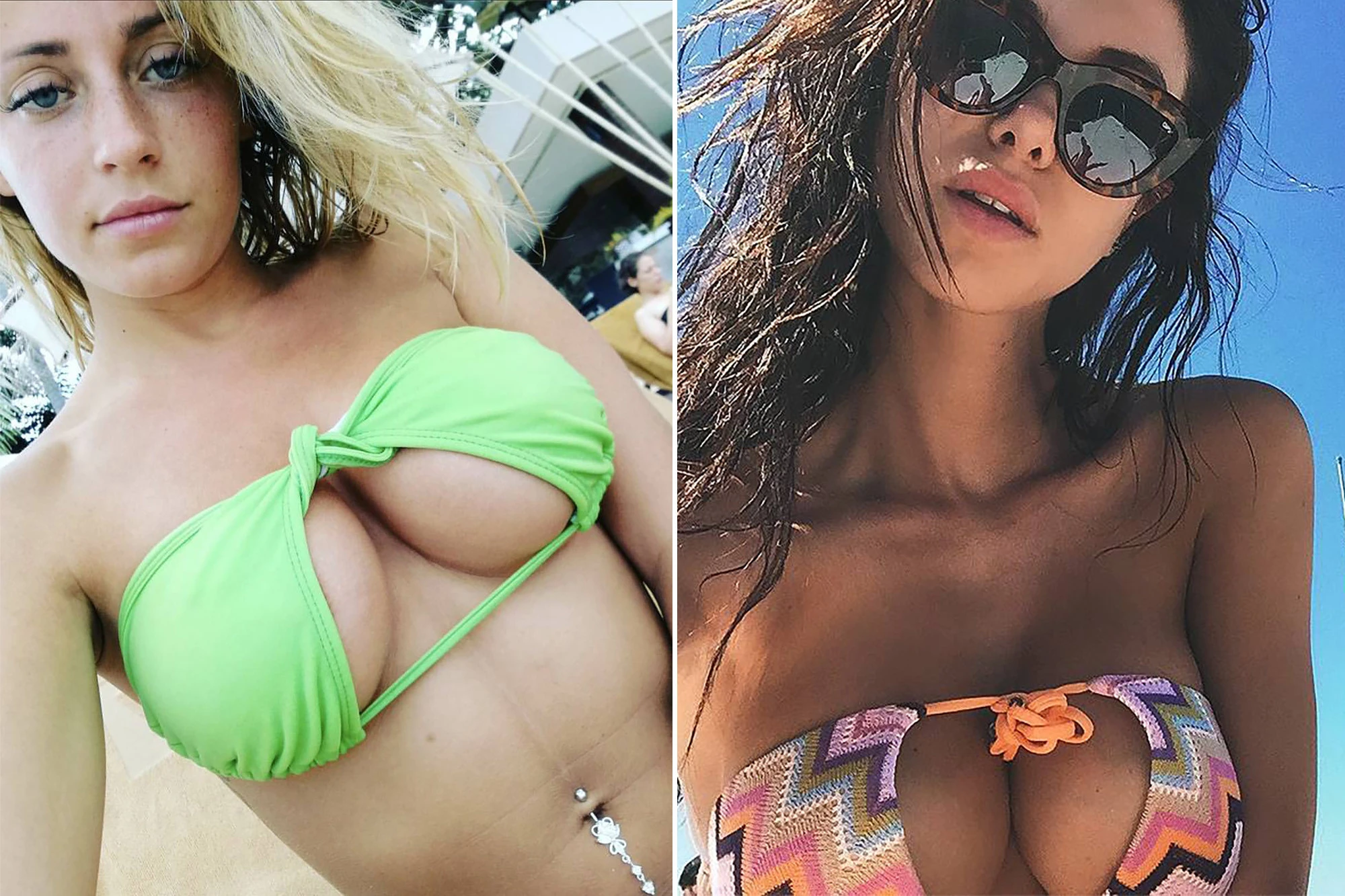 Mostarke na aparatima: Novi način nošenja kupaćih kostima zaludio Instagram