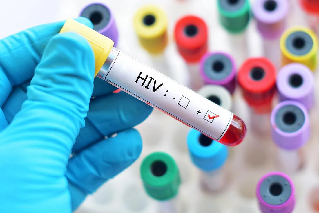 U RS-u 122 osobe oboljele od HIV/AIDS-a, umrlo njih 20