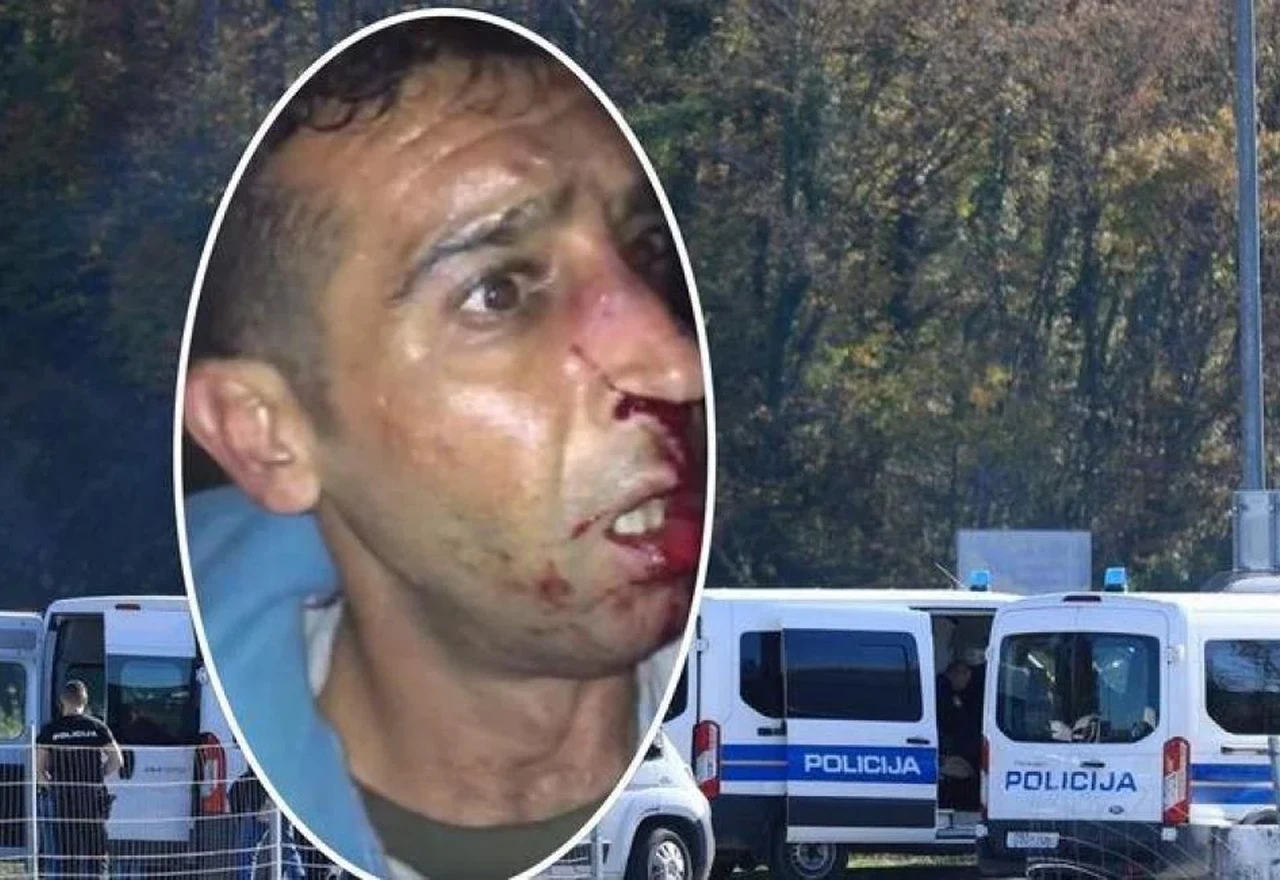 Hrvatski MUP zaprepašten tvrdnjama Guardiana o zlostavljanju migranata