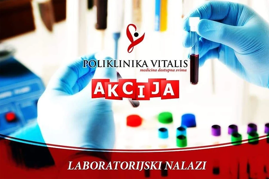 Movember u Poliklinici Vitalis