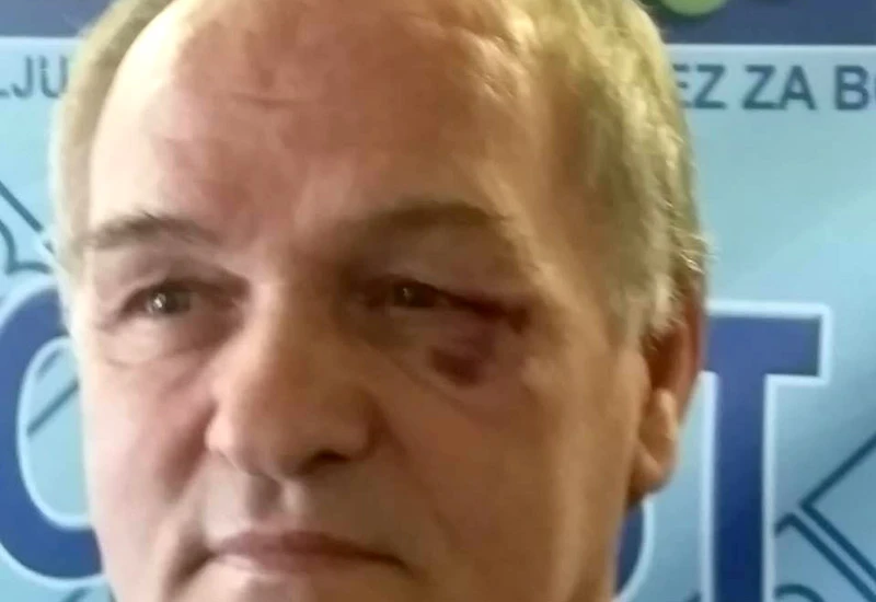 Zastupnika napali dok je lijepio plakat 
