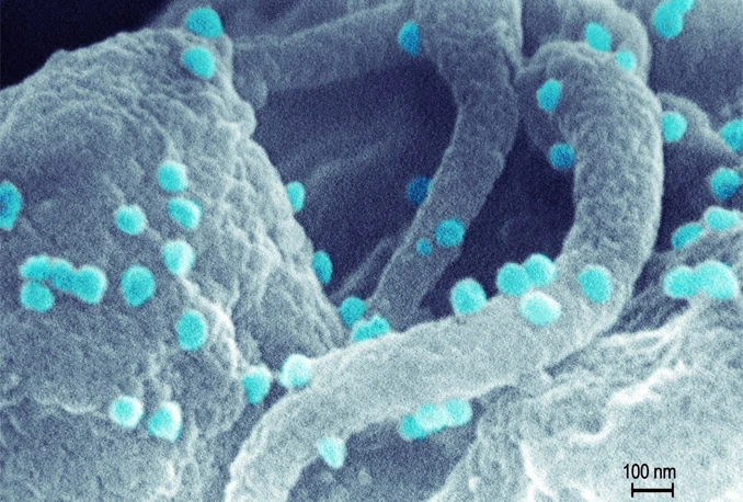 Virus stariji od čovjeka kriv za sve naše ovisnosti?