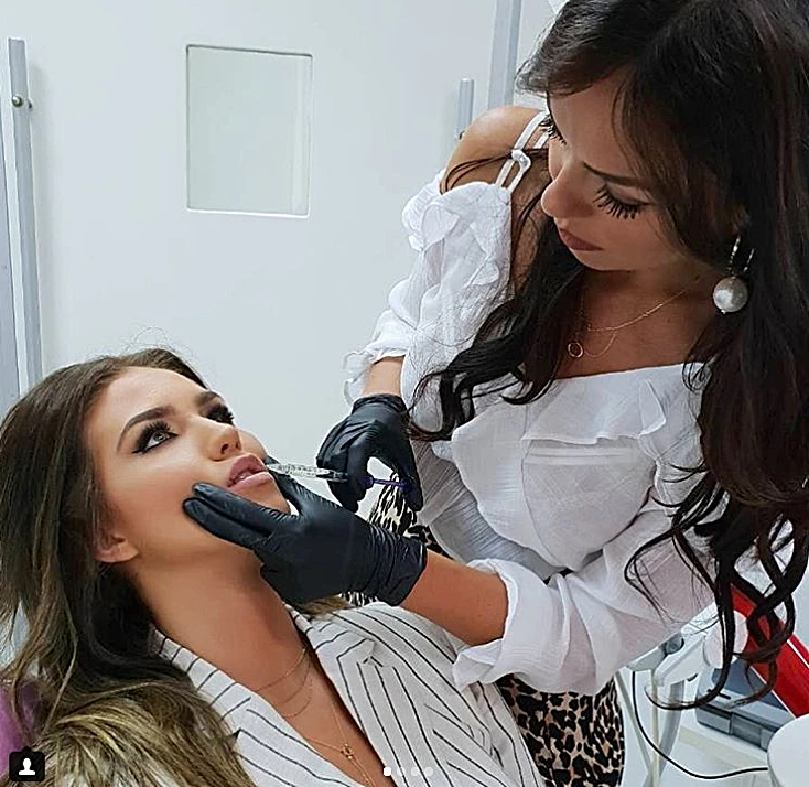 Ana Bavrka povećala usne