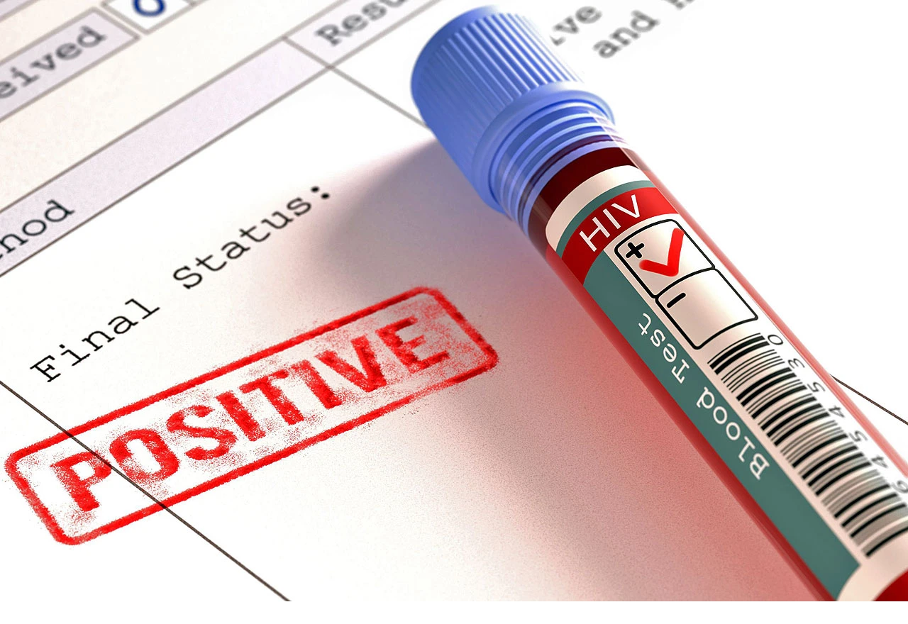 Znanstvenici tvrde da su pronašli novi lijek za HIV
