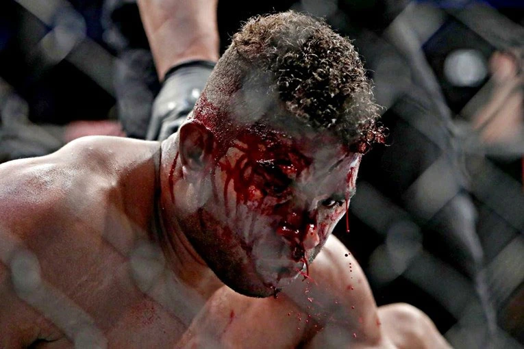 Overeem brutalno nastradao, Blaydes ga izudarao laktovima