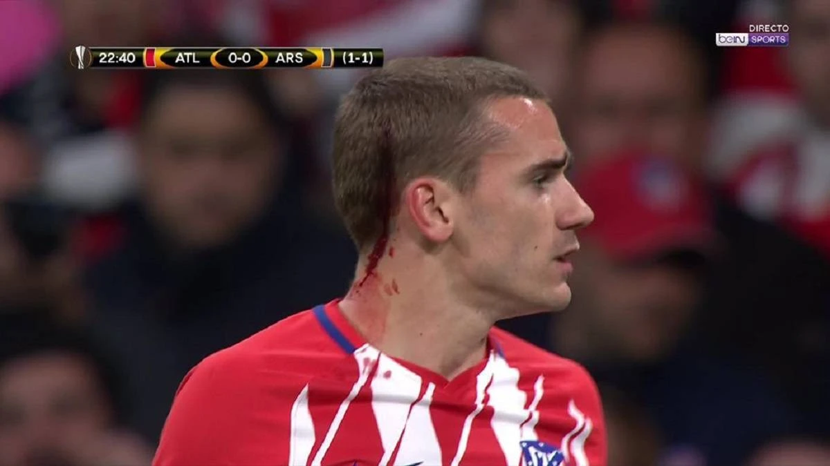 Griezmann odigrao 25 minuta s krvavom ranom na glavi