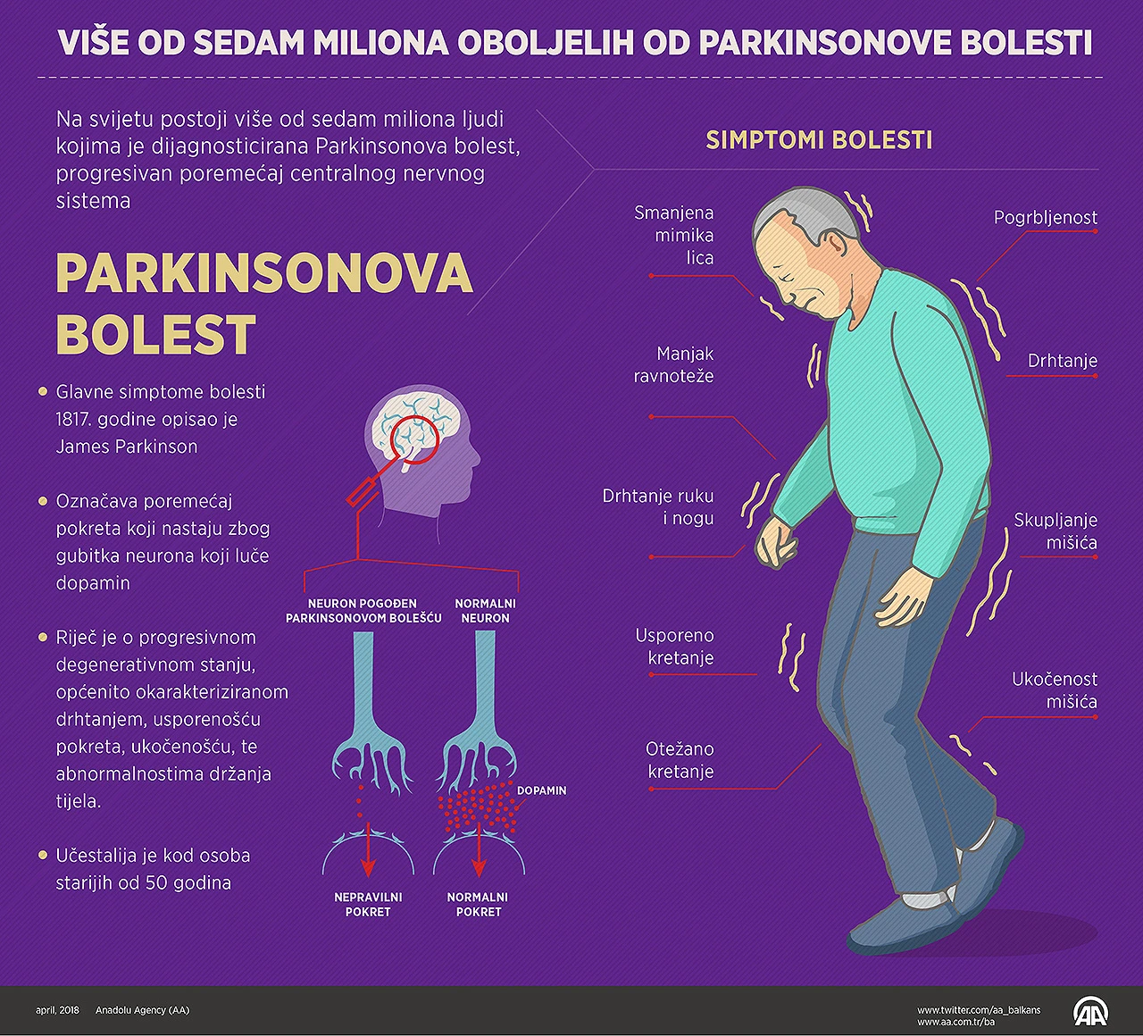 Širom svijeta više od sedam milijuna oboljelih od Parkinsonove bolesti
