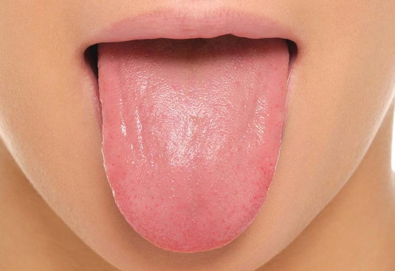 Promjena boje jezika otkrit će infekcije i nedostatak vitamina