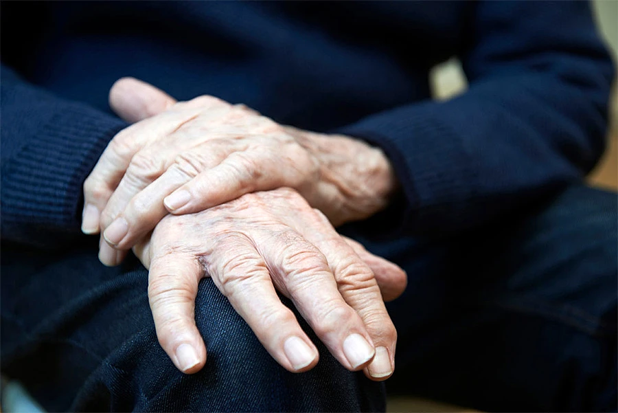 Skrivena strana Parkinsonove bolesti