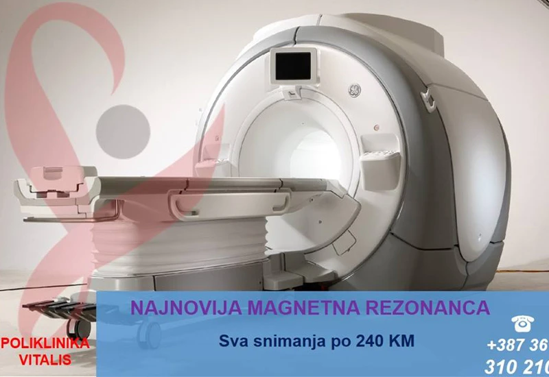 Poliklinika ''Vitalis'' produžuje akciju magnetne rezonance u travnju