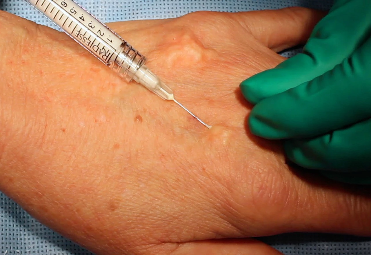 Osumnjičena: Medicinska sestra ubila muža cijanidom