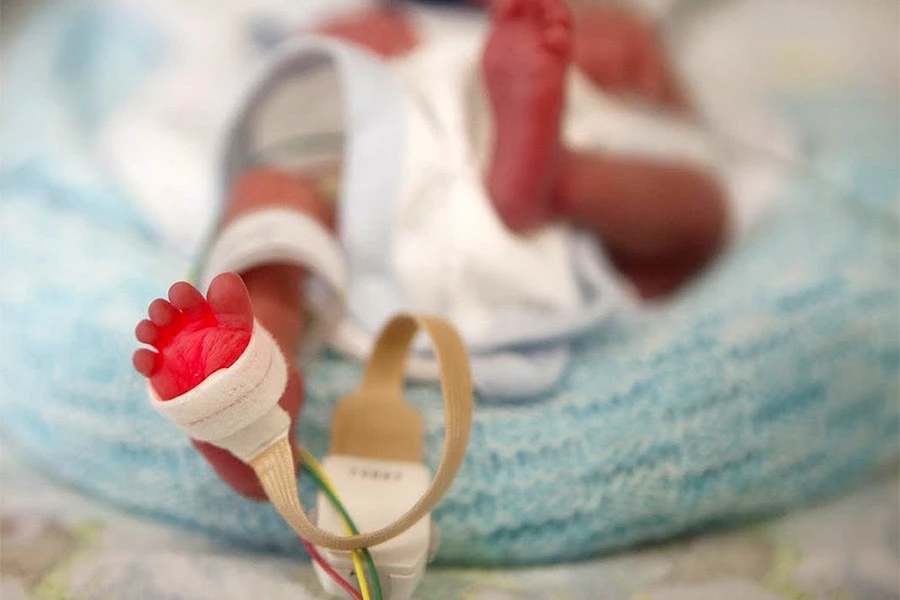 U Srbiji rođena zdrava beba teška samo 350 grama