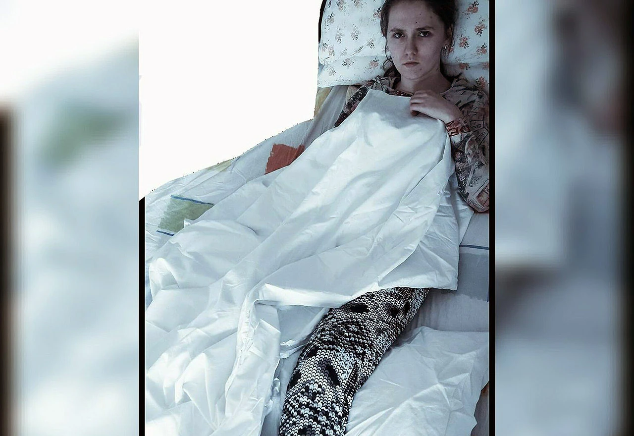Učenici trećeg razreda gimnazije nedostaje 65.000 eura za operaciju u Njemačkoj