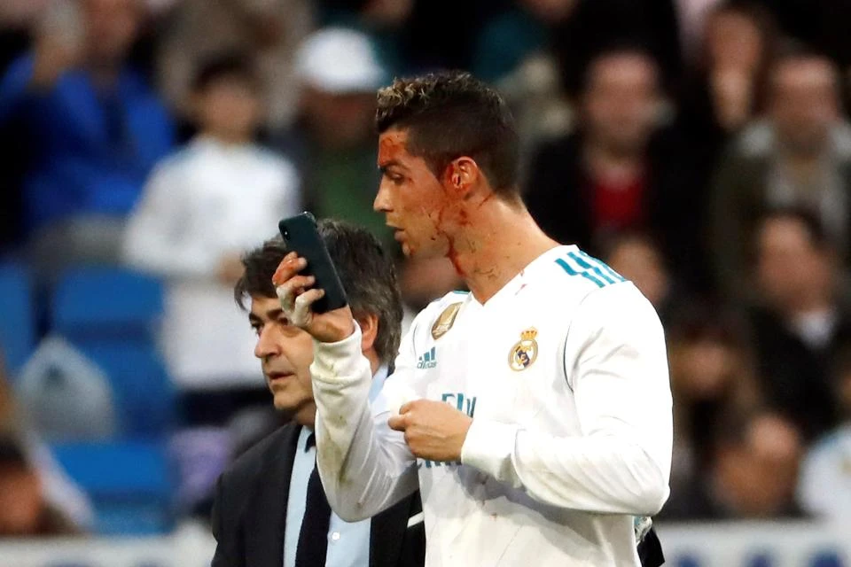 Obliven krvlju Cristiano Ronaldo tražio mobitel da se pogleda!?