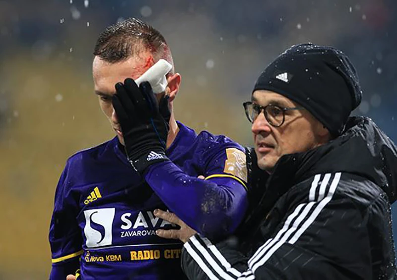 Jasmin Mešanović primio težak udarac u glavu, mora na operaciju 