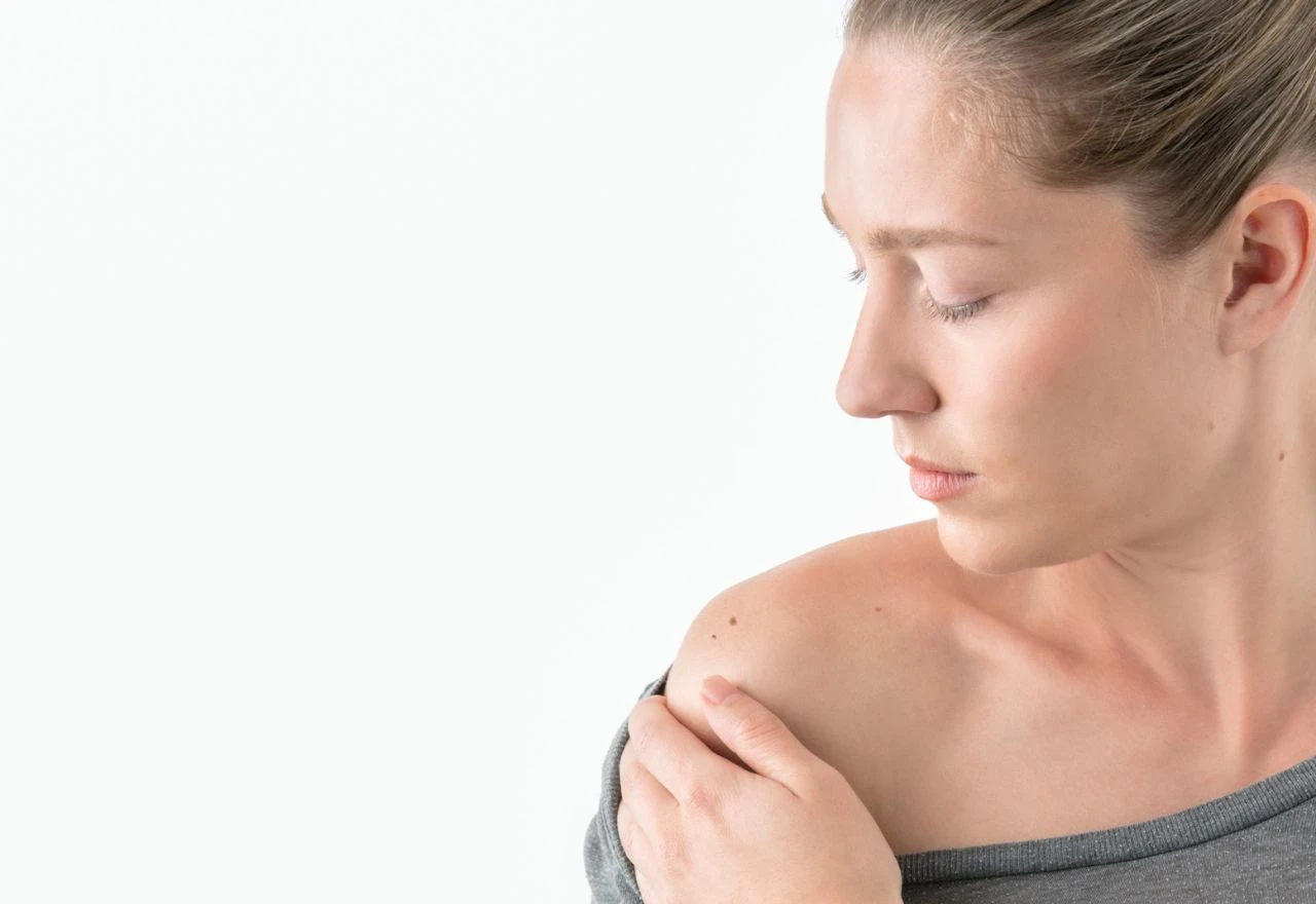 Jesu li crveni madeži na koži opasni? Evo što dermatolozi kažu