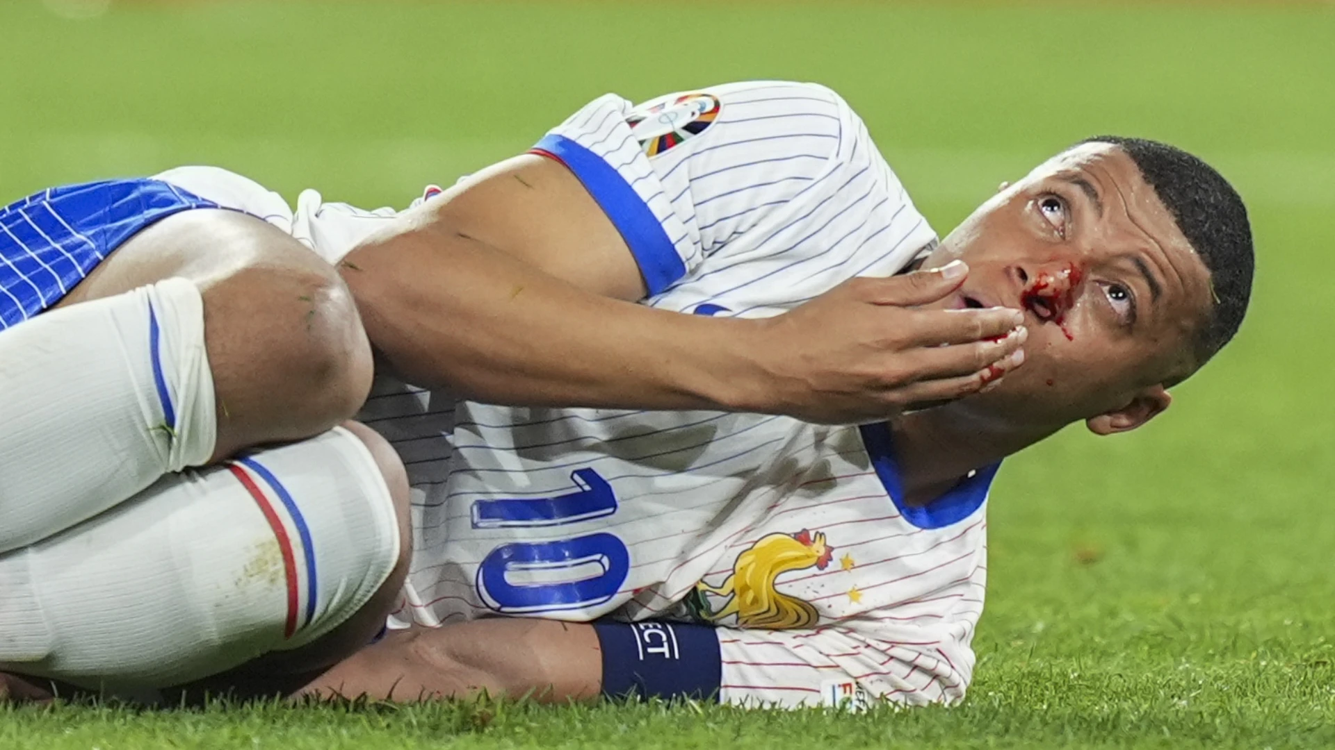 VIDEO I Mbappé slomio nos, upitan nastavak prvenstva