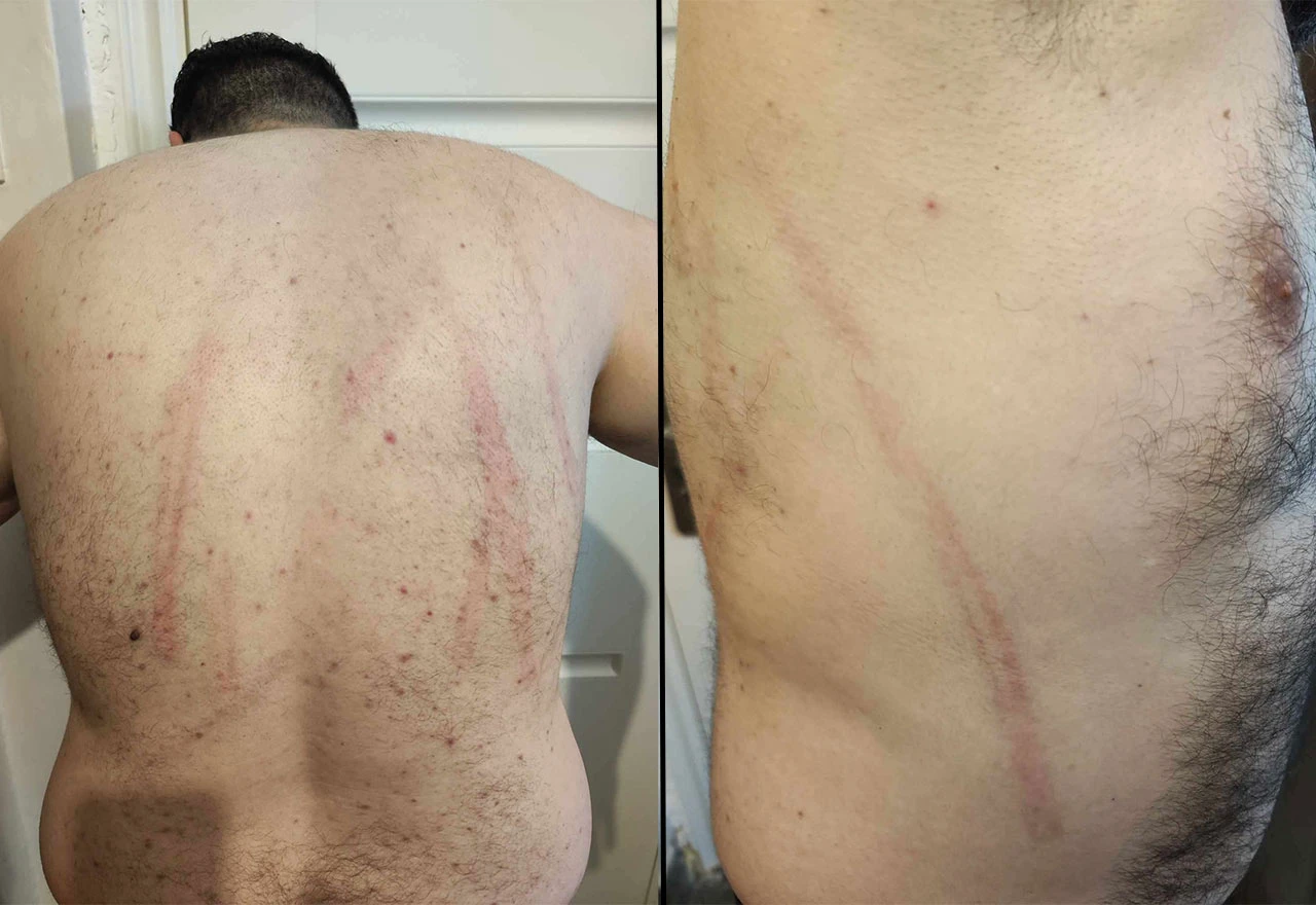 Mostarska policija se oglasila o napadu, novinar najavio tužbe