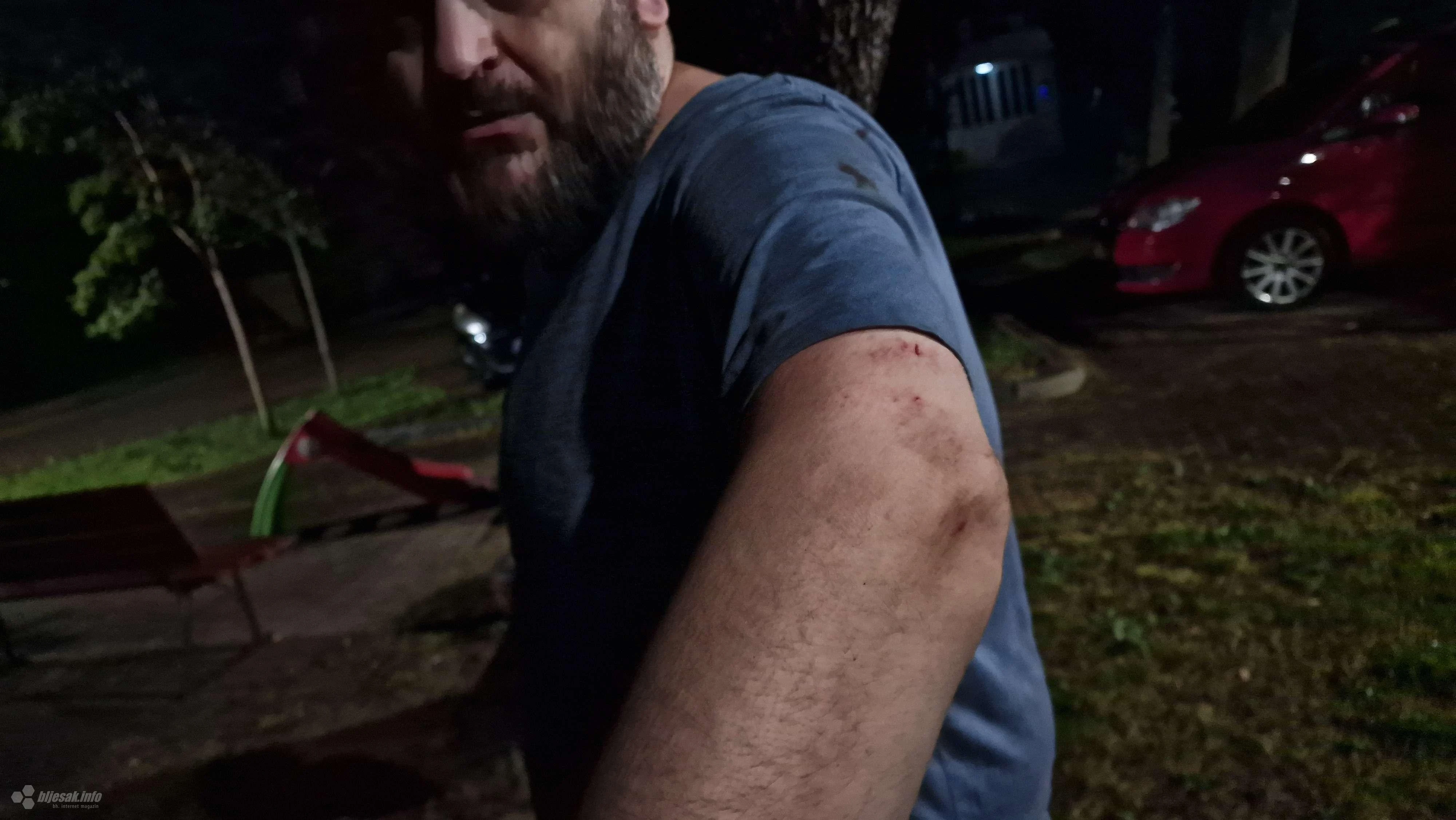 Rodoč: Policajac pendrekom pretukao novinara zbog psa
