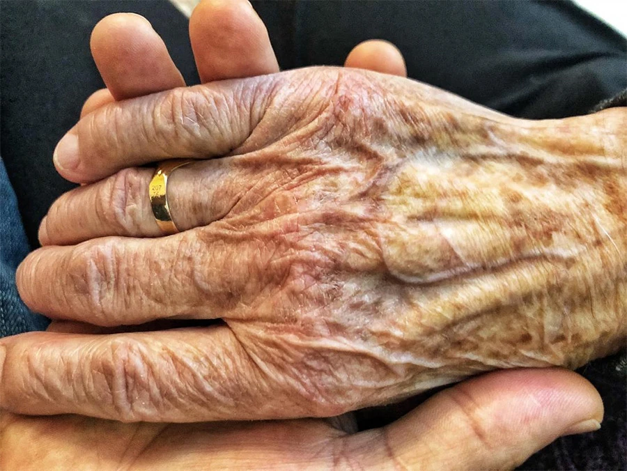 Od Parkinsonove bolesti u svijetu boluje oko deset milijuna ljudi