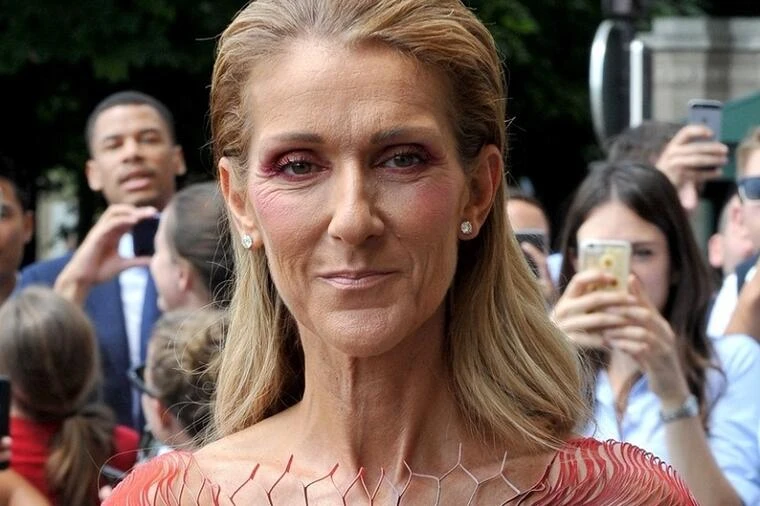 I Am: Céline Dion: Stiže dokumentarac s ciljem podizanja svijesti o teškom sindromu