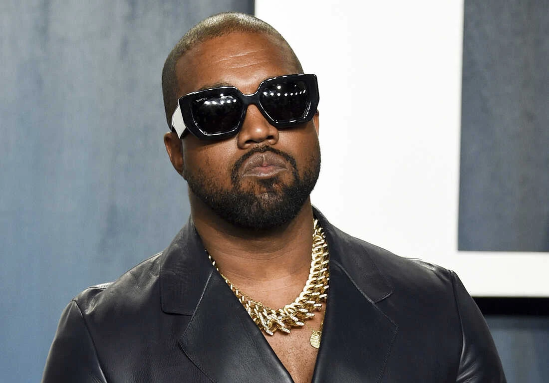 Kanye West opet šokira. Izvadio sve svoje zube i zamijenio ih protezom koja košta 850.000 eura!