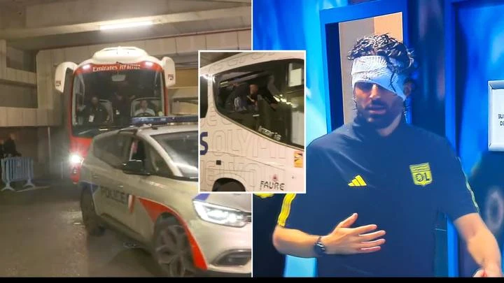 Navijači Marseilla kamenovali autobus Lyona, trener Grosso pogođen u glavu