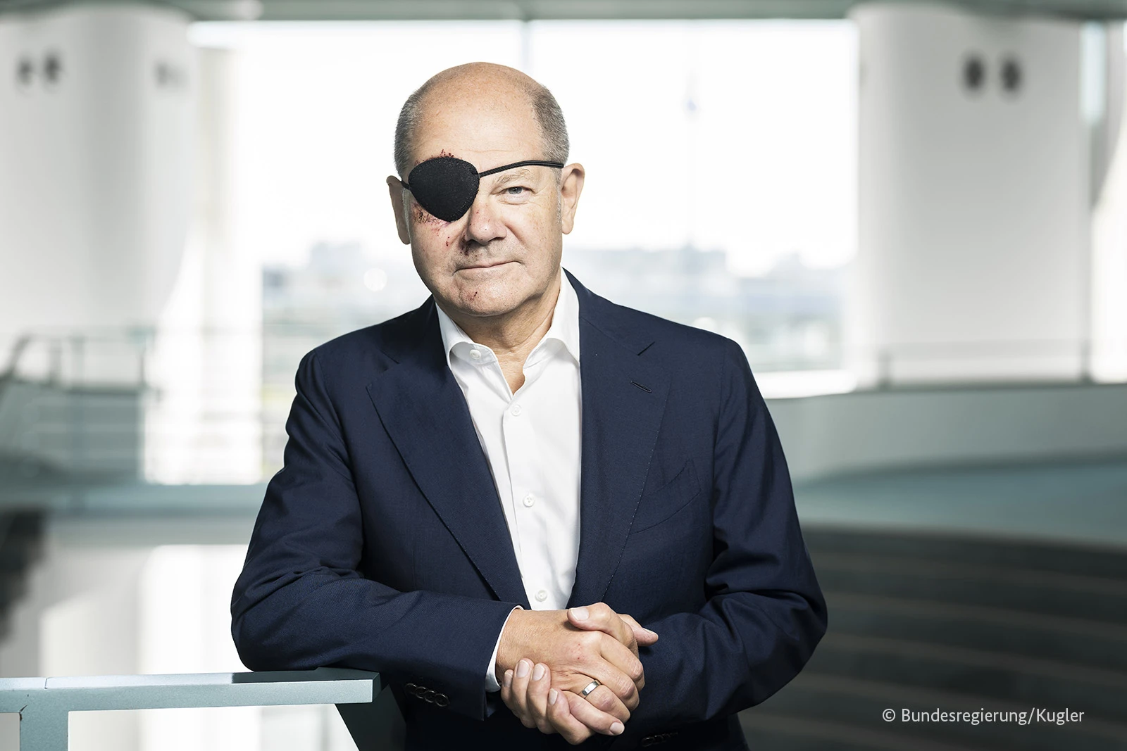 Njemački kancelar Scholz s povezom na oku nakon pada na trčanju