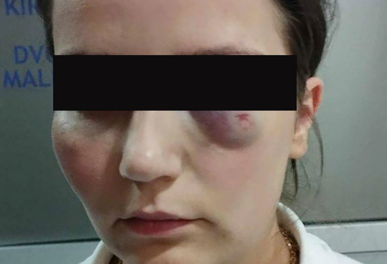 Najavljeni prosvjedi zbog pretučene radnice u Jablanici