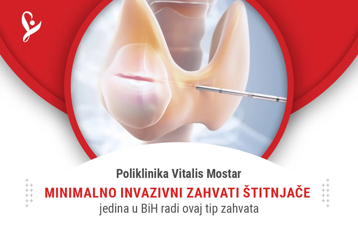 Minimalno invazivni zahvati štitnjače samo u Poliklinici Vitalis
