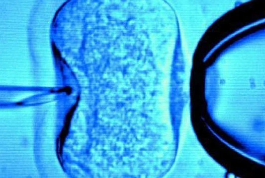 Do sada dostavljeno 159 zahtjeva za biomedicinski potpomognutu oplodnju