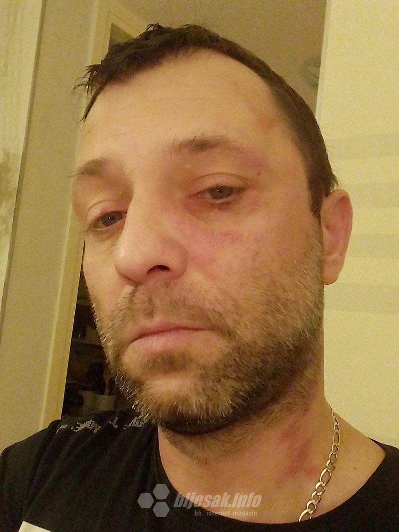 Mostarac tvrdi: Policija ga izvela iz kuće i (greškom) pretukla