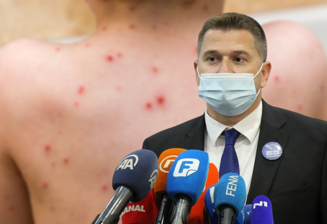 Tužiteljstvo HNŽ preuzelo prijavu protiv Skočibušića zbog vode