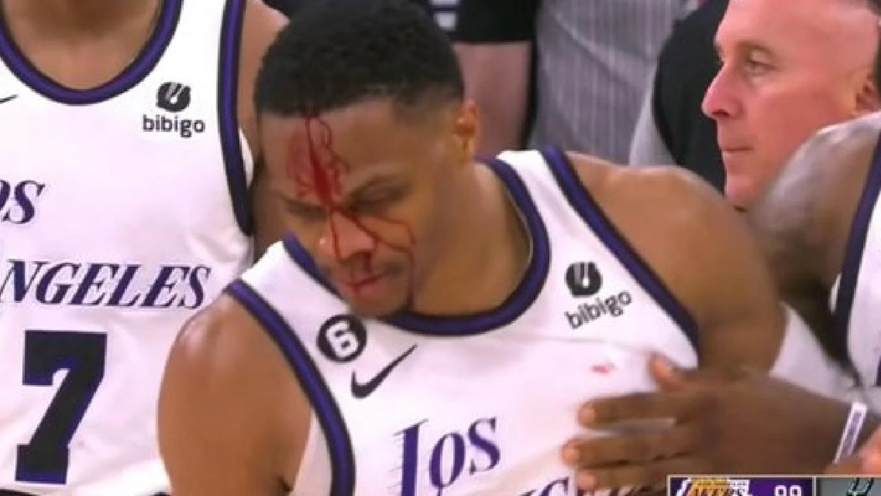 Potekla krv, Westbrook dobio po glavi