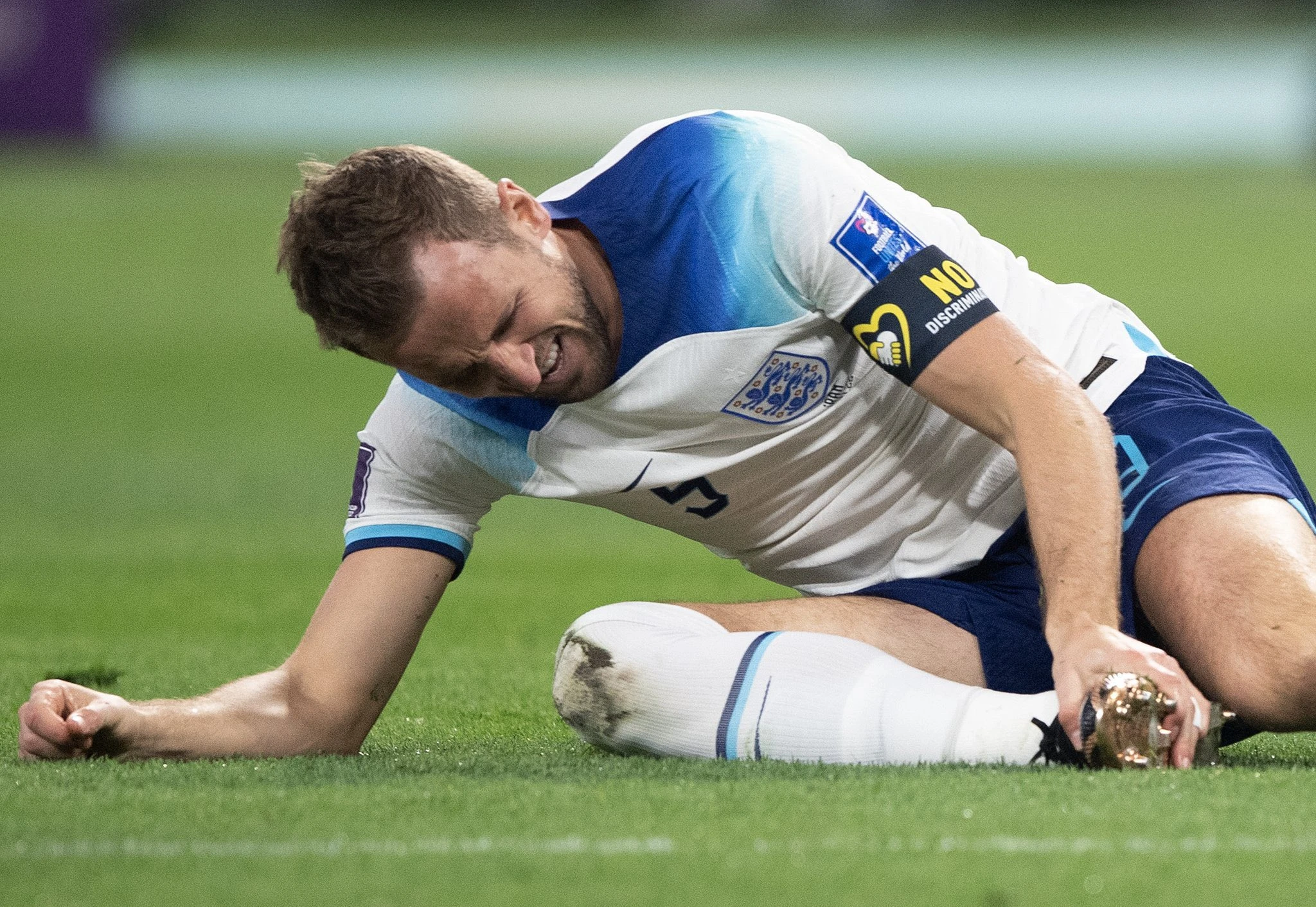 Harry Kane mora na snimanje gležnja