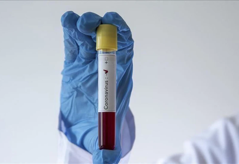 Koronavirus u BiH: Najmanje 908 novozaraženih, 21 osoba preminula, prepoznajte simptome