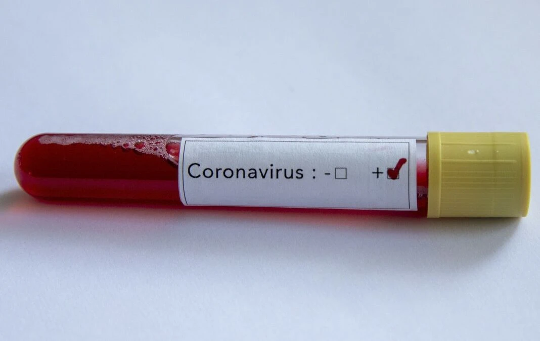 Češka ima rekordan broj zaraženih, Italija razmišlja do srpnja produljiti mjere