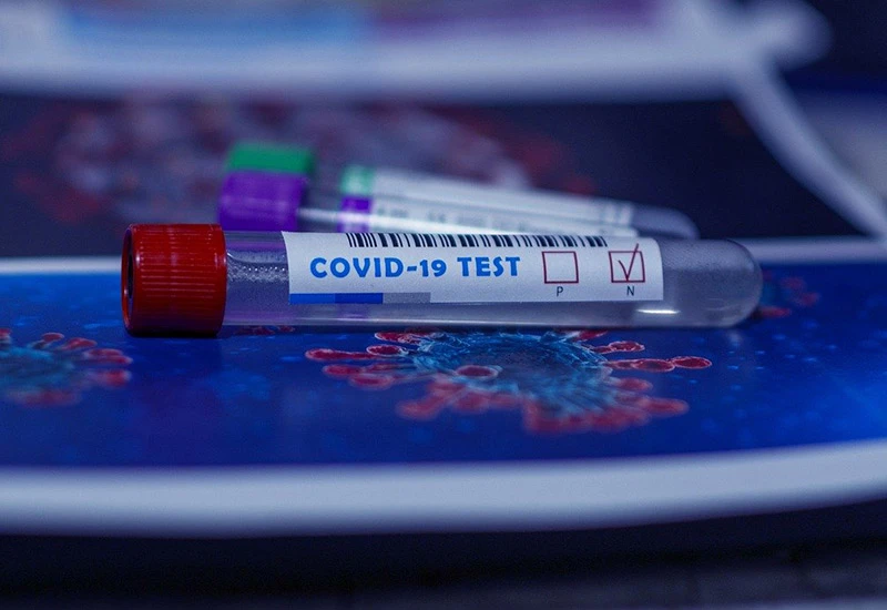 Predstavljen test koji razlikuje gripu od infekcije COVID-19
